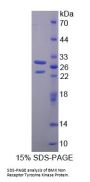 Human BMX Non Receptor Tyrosine Kinase (BMX) Protein