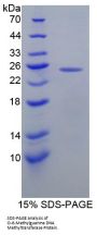 Human O-6-Methylguanine DNA Methyltransferase (MGMT) Protein
