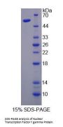 Human Nuclear Transcription Factor Y Gamma (NFYC) Protein