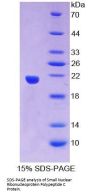 Human Small Nuclear Ribonucleoprotein Polypeptide C (SNRPC) Protein