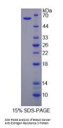 Human Breast Cancer Anti-Estrogen Resistance 3 (BCAR3) Protein