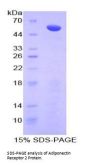 Human Adiponectin Receptor 2 (ADIPOR2) Protein