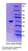 Human Neutrophil Specific Antigen 1 (NB1) Protein