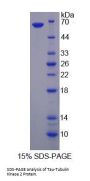 Human Tau-Tubulin Kinase 2 (TTBK2) Protein