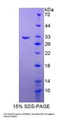 Human RAB5A, Member RAS Oncogene Family (RAB5A) Protein