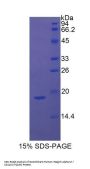 Human Integrin Alpha M / CD11b (ITGAM) Protein