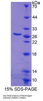 Mouse Plasminogen Activator Inhibitor 1 (PAI1) Protein