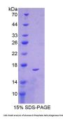 Mouse Glucose-6-Phosphate Dehydrogenase (G6PD) Protein