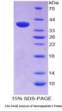 Mouse Neuropeptide S (NPS) Protein