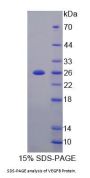 Mouse Vascular Endothelial Growth Factor B (VEGFB) Protein