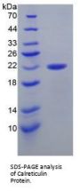 Mouse Calreticulin (CALR) Protein