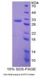 Mouse Activating Transcription Factor 1 (ATF1) Protein
