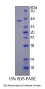 Mouse Sulfatase 2 (SULF2) Protein