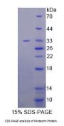 Mouse Meteorin (METRN) Protein
