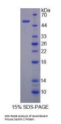 Mouse Sestrin 2 (SESN2) Protein