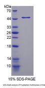 Mouse Tryptophan Hydroxylase 2 (TPH2) Protein