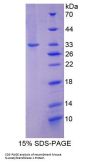 Mouse N-Acetyltransferase 1 (NAT1) Protein