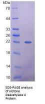 Mouse Histone Deacetylase 4 (HDAC4) Protein