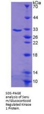 Mouse Serum/Glucocorticoid Regulated Kinase 1 (SGK1) Protein