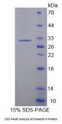 Mouse Contactin 6 (CNTN6) Protein