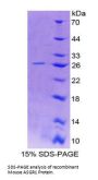 Mouse Asialoglycoprotein Receptor 1 (ASGR1) Protein
