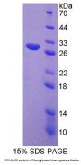 Mouse Diacylglycerol Kinase Gamma (DGKg) Protein