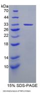 Mouse Transient Receptor Potential Cation Channel Subfamily V, Member 2 (TRPV2) Protein