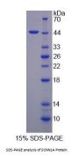 Mouse Amiloride Sensitive Sodium Channel Subunit Alpha (SCNN1a) Protein