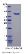Rat Nestin (NES) Protein