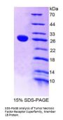 Rat Tumor Necrosis Factor Receptor Superfamily Member 1B / CD120b (TNFRSF1B) Protein