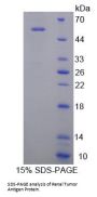 Rat MAPK/MAK/MRK Overlapping Kinase (MOK) Protein