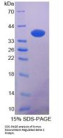 Rat N-myc Downstream Regulated Gene 2 (NDRG2) Protein