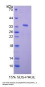 Rat Complement Component 1, Q Receptor (C1qR1) Protein