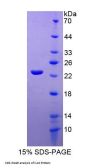 Rat Interleukin 10 (IL10) Protein