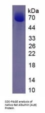 Rat Albumin (ALB) Protein