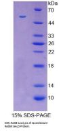 Rabbit Galectin 3 (LGALS3) Protein