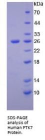 Human Inactive Tyrosine-Protein Kinase 7 (PTK7) Protein