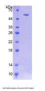 Human Heat Shock Transcription Factor 2 (HSF2) Protein