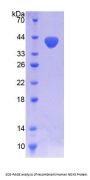 Human Nicotinamide Adenine Dinucleotide Phosphate Oxidase 5 (NOX5) Protein