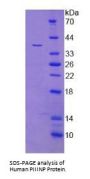 Human Procollagen Type III N-Terminal Propeptide (PIIINP) Protein