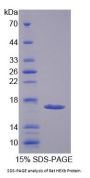Rat Hexosaminidase B Beta (HEXb) Protein