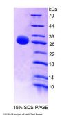 Rat Glutathione S Transferase Mu 4 (GSTm4) Protein
