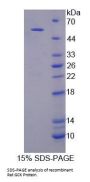 Rat Hexokinase-4 (GCK) Protein