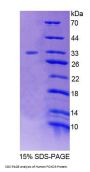 Human Forkhead Box Protein O3 (FOXO3) Protein