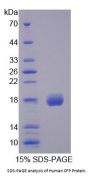 Human Complement Factor P (CFP) Protein