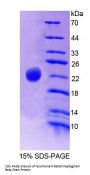 Rabbit Haptoglobin Beta Chain (HP) Protein
