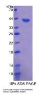 Human CD9 Antigen (CD9) Protein