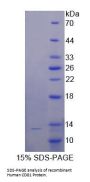 Human Cluster of Differentiation 81 (CD81) Protein
