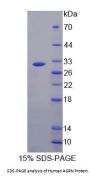 Human Agrin (AGRN) Protein