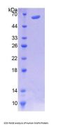 Human Microtubule Associated Protein 4 (MAP4) Protein